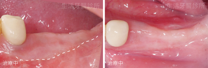 台中牙醫診所推薦