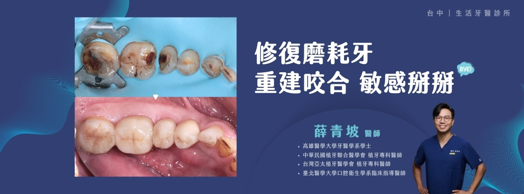 磨牙牙齒酸軟敏感變短+台中牙醫推薦生活牙醫+全瓷冠假牙+陶瓷嵌體